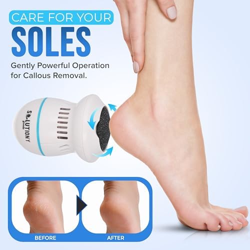 Electric Foot Callus Remover - USB-Rechargeable With Built-in Vacuum